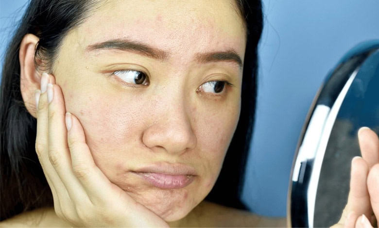 چطور کورتیزول بالا به پوست آسیب می‌زند و چگونه می‌توان آن را متعادل کرد؟